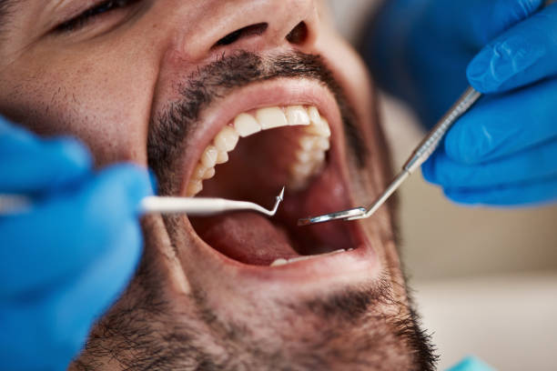 Emergency Dental Services in Tarrant, AL